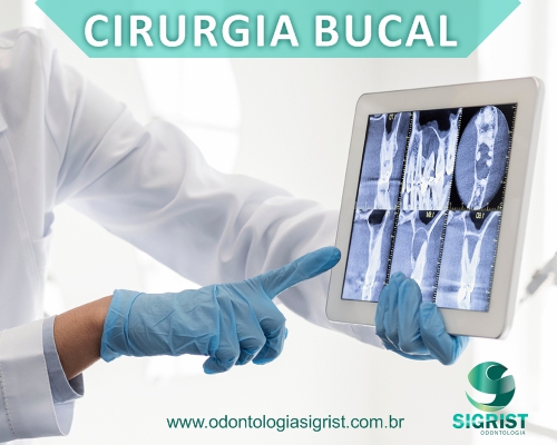 Cirurgia Bucal